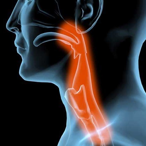 dysphagia